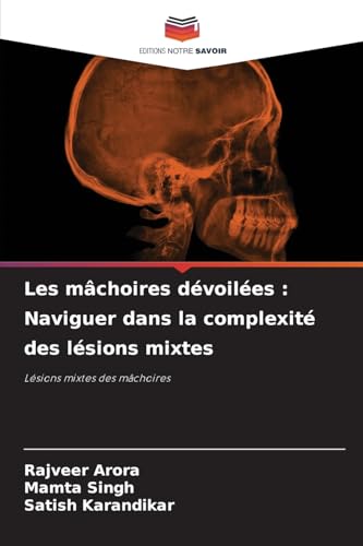 Les mâchoires dévoilées : Naviguer dans la complexité des lésions mixtes: Lésions mixtes des mâchoires von Editions Notre Savoir
