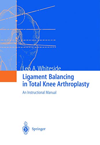Ligament Balancing in Total Knee Arthroplasty: An Instructional Manual von Springer