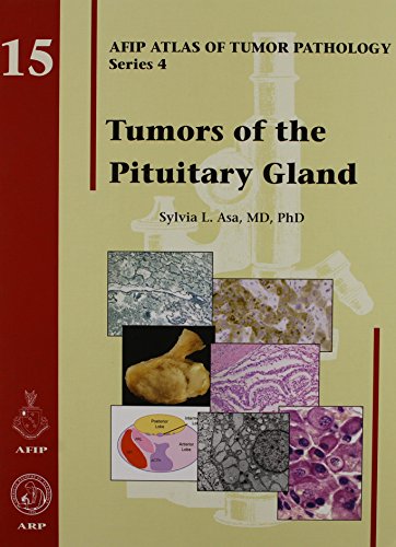 Tumors of the Pituitary Gland: AFIP Atlas of Tumor Pathology, Series 4