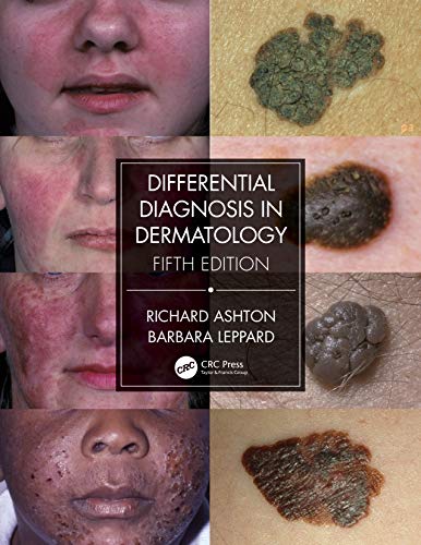 Differential Diagnosis in Dermatology von CRC Press