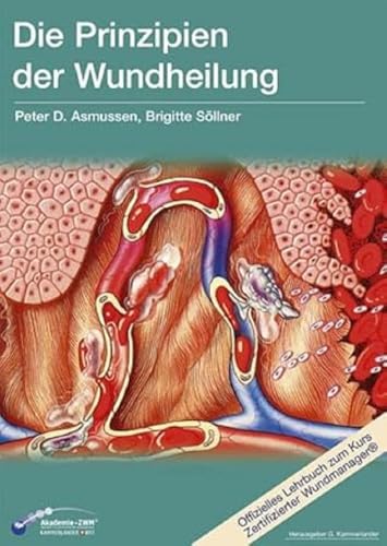 Die Prinzipien der Wundheilung: Wundtypen, Wundheilungsvorgänge und Wundheilungsstörungen