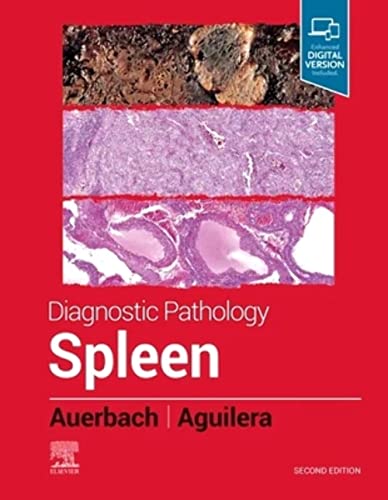 Diagnostic Pathology: Spleen von Elsevier