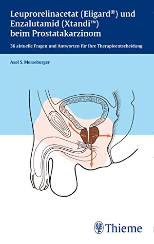 Leuprorelinacetat (Eligard®) und Enzalutamid (Xtandi) beim Prostatakarzinom: 36 aktuelle Fragen und Antworten für Ihre Therapieentscheidung