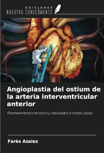 Angioplastia del ostium de la arteria interventricular anterior: Planteamientos técnicos y resultados a medio plazo von Ediciones Nuestro Conocimiento
