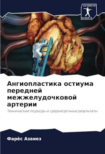 Ангиопластика остиума передней межжелудочковой артерии: Технические подходы и среднесрочные результаты: Tehnicheskie podhody i srednesrochnye rezul'taty Ангиопластика остиума передней межжелудочковой артерии: Технические подходы и среднесрочные результаты: Tehnicheskie podhody i srednesrochnye rezul'taty