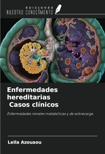 Enfermedades hereditarias Casos clínicos: Enfermedades renales metabólicas y de sobrecarga von Ediciones Nuestro Conocimiento