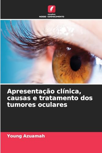 Apresentação clínica, causas e tratamento dos tumores oculares: DE von Edições Nosso Conhecimento