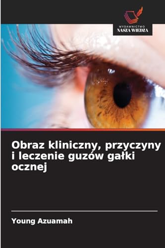 Obraz kliniczny, przyczyny i leczenie guzów ga¿ki ocznej: DE von Wydawnictwo Nasza Wiedza