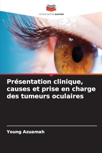 Présentation clinique, causes et prise en charge des tumeurs oculaires von Editions Notre Savoir