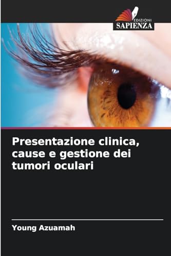 Presentazione clinica, cause e gestione dei tumori oculari von Edizioni Sapienza