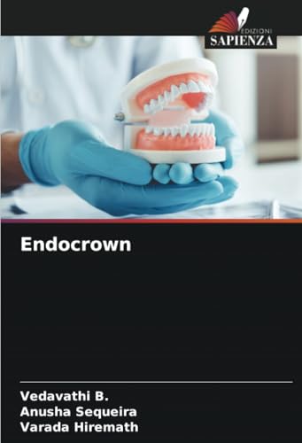 Endocrown: DE von Edizioni Sapienza