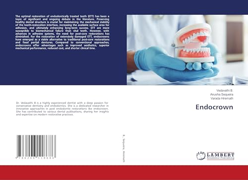 Endocrown: DE von LAP LAMBERT Academic Publishing