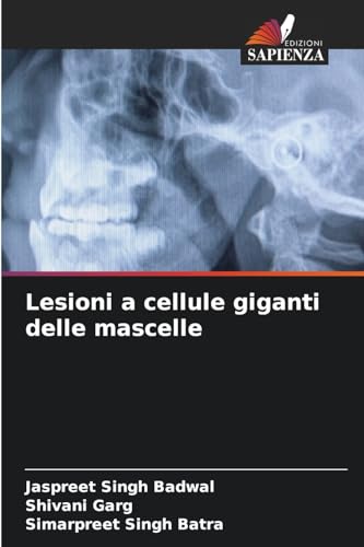 Lesioni a cellule giganti delle mascelle von Edizioni Sapienza