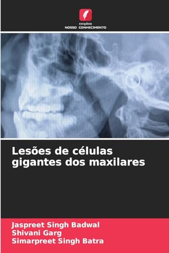 Lesões de células gigantes dos maxilares von Edições Nosso Conhecimento