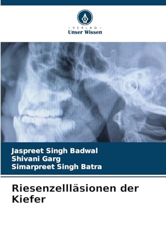 Riesenzellläsionen der Kiefer von Verlag Unser Wissen