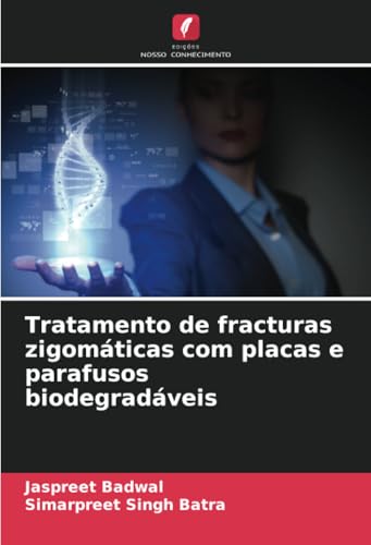 Tratamento de fracturas zigomáticas com placas e parafusos biodegradáveis von Edições Nosso Conhecimento