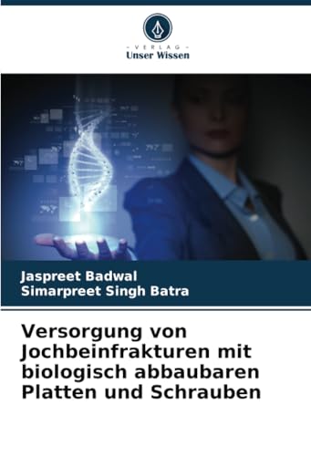 Versorgung von Jochbeinfrakturen mit biologisch abbaubaren Platten und Schrauben: DE von Verlag Unser Wissen