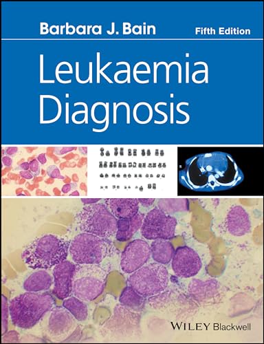 Leukaemia Diagnosis von Wiley