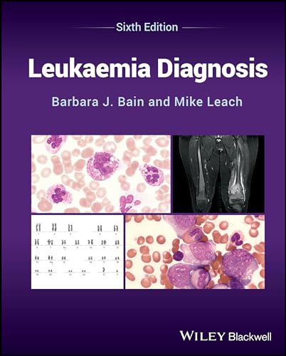Leukaemia Diagnosis von Wiley-Blackwell