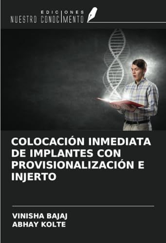 COLOCACIÓN INMEDIATA DE IMPLANTES CON PROVISIONALIZACIÓN E INJERTO von Ediciones Nuestro Conocimiento