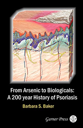 From Arsenic To Biologicals: A 200 Year History Of Psoriasis von Garner Press