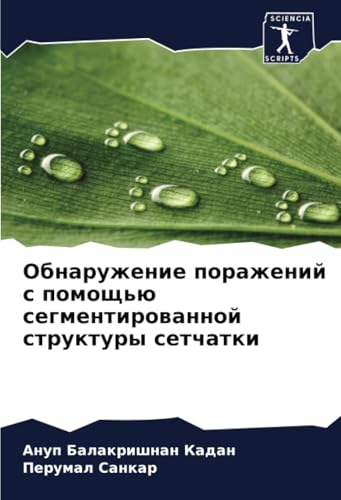 Обнаружение поражений с помощью сегментированной структуры сетчатки: DE von Sciencia Scripts