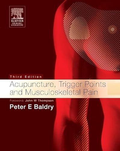 Acupuncture, Trigger Points and Musculoskeletal Pain (Acupuncture, Trigger Points, & Musculoskeletal Pain)