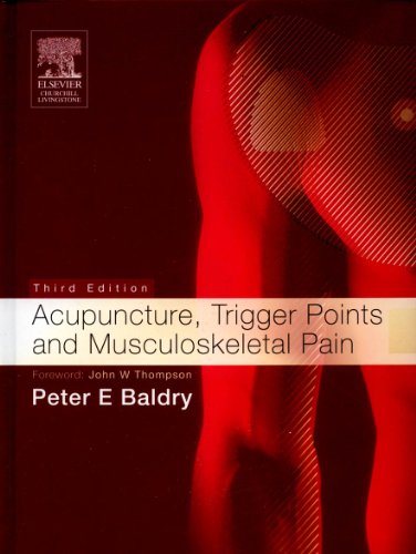 Acupuncture, Trigger Points and Musculoskeletal Pain (Acupuncture, Trigger Points, & Musculoskeletal Pain)