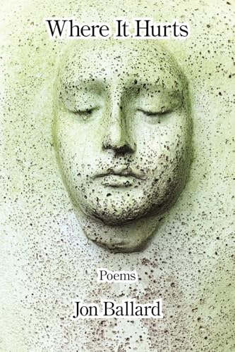 Where It Hurts von Kelsay Books