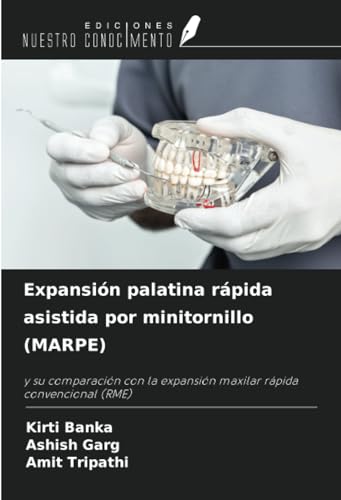 Expansión palatina rápida asistida por minitornillo (MARPE): y su comparación con la expansión maxilar rápida convencional (RME) von Ediciones Nuestro Conocimiento