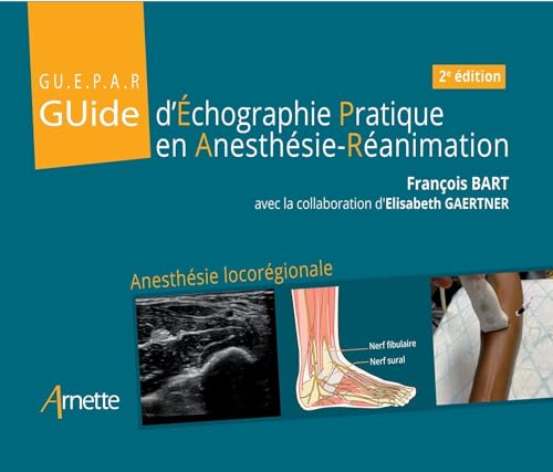 Guide d'échographie pratique en anesthésie-réanimation von ARNETTE EDITION