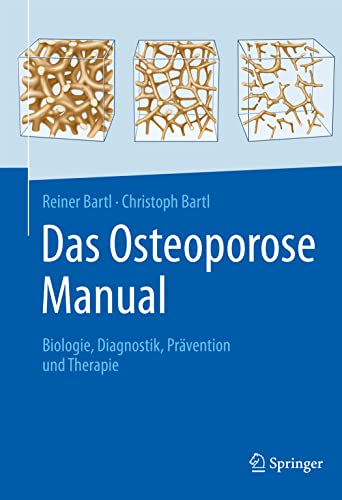 Das Osteoporose Manual: Biologie, Diagnostik, Prävention und Therapie von Springer