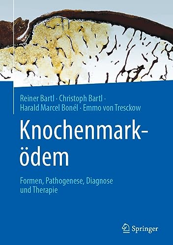 Knochenmarködem: Formen, Pathogenese, Diagnose und Therapie