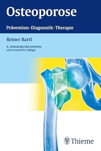 Osteoporose