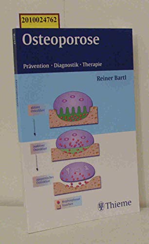 Osteoporose. Prävention-Diagnostik-Therapie