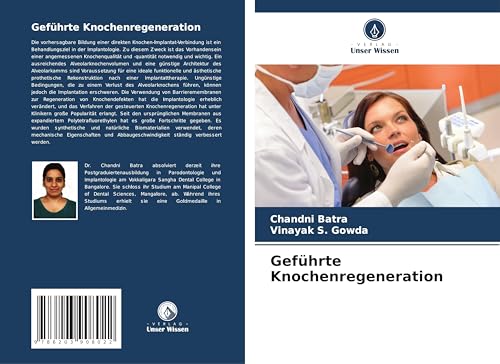 Geführte Knochenregeneration: DE von Verlag Unser Wissen