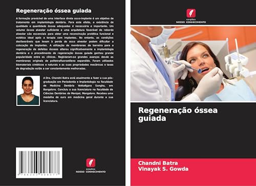 Regeneração óssea guiada: DE von Edições Nosso Conhecimento