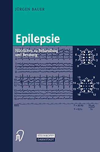 Epilepsie. Nützliches zu Behandlung und Beratung Epilepsie. Nützliches zu Behandlung und Beratung von Springer