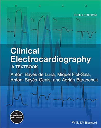 Clinical Electrocardiography: A Textbook von John Wiley & Sons Inc