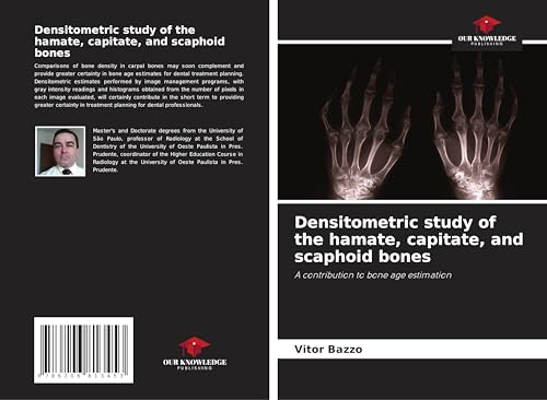 Densitometric study of the hamate, capitate, and scaphoid bones: A contribution to bone age estimation von Our Knowledge Publishing