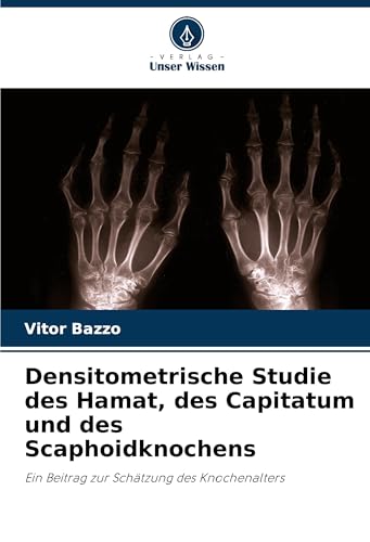 Densitometrische Studie des Hamat, des Capitatum und des Scaphoidknochens: Ein Beitrag zur Schätzung des Knochenalters von Verlag Unser Wissen