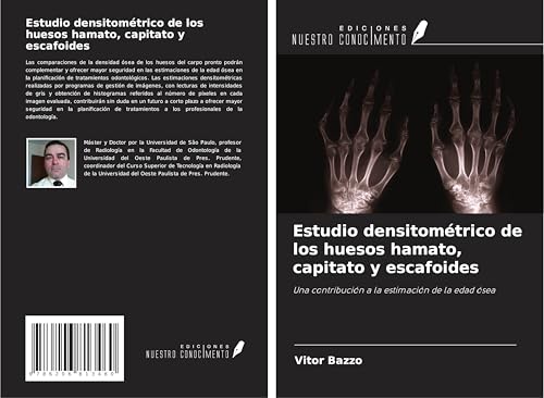 Estudio densitométrico de los huesos hamato, capitato y escafoides: Una contribución a la estimación de la edad ósea von Ediciones Nuestro Conocimiento