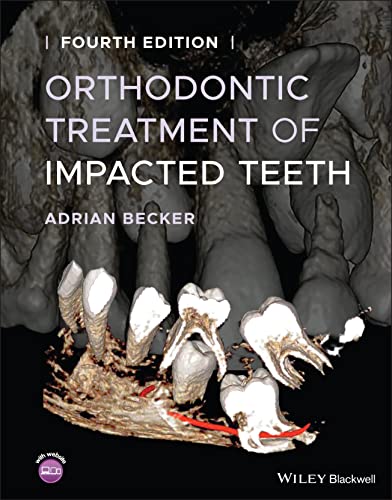 Orthodontic Treatment of Impacted Teeth von Wiley-Blackwell