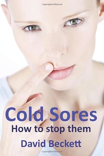 Cold Sores: How to stop them von Independently published