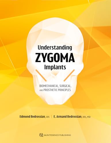 Understanding Zygoma Implants: Biomechanical, Surgical, and Prosthetic Principles von Quintessence Publishing