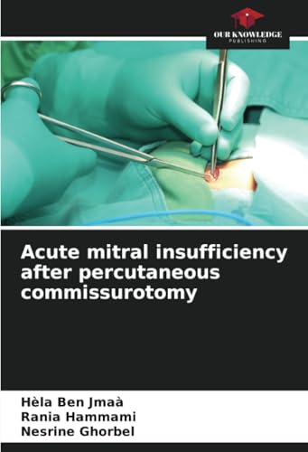 Acute mitral insufficiency after percutaneous commissurotomy: DE von Our Knowledge Publishing