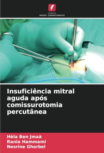 Insuficiência mitral aguda após comissurotomia percutânea: DE von Edições Nosso Conhecimento