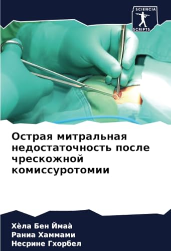 Острая митральная недостаточность после чрескожной комиссуротомии: DE von Sciencia Scripts