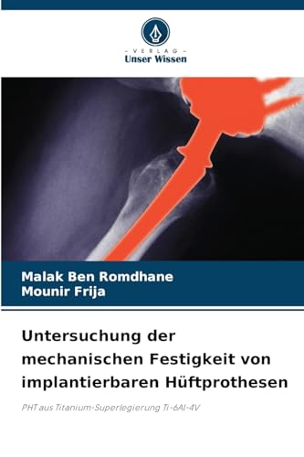 Untersuchung der mechanischen Festigkeit von implantierbaren Hüftprothesen: PHT aus Titanium-Superlegierung Ti-6Al-4V von Verlag Unser Wissen