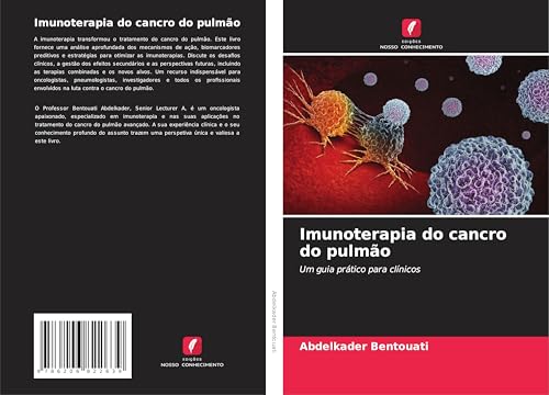 Imunoterapia do cancro do pulmão: Um guia prático para clínicos von Edições Nosso Conhecimento